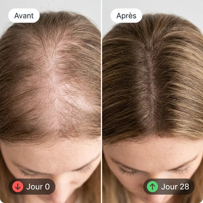 Formule DHT | Softgels Capillaires