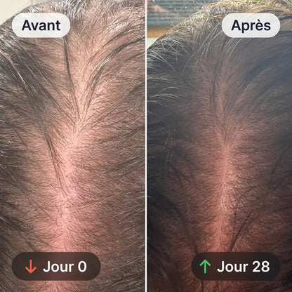 Formule DHT | Softgels Capillaires